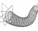 Terumo Roadsaver carotid stent | Used in Carotid stenting | Which Medical Device